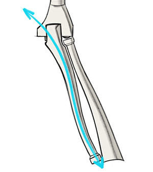 S curve rhythm of the ulna bones
