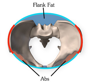 What surrounds the pelvis to give it the bucket shape