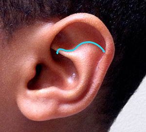 volume of the antihelix