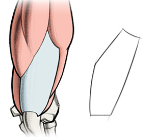 asymmetrical long pentagon shape of the triceps tendon