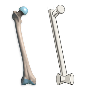 Simplified Femur 3d Sketch