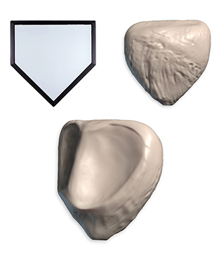 Patella shape and grooves