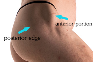 Landmarks of the gluteus medius