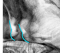 muscular edge and squished fat