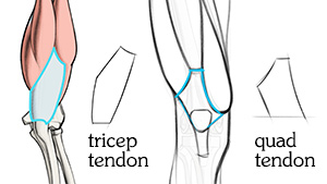 Tendonul tricepsului vs. tendonul cvadrantului