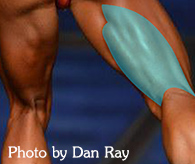 The hamstrings don't span the full width of the back of the thigh