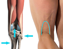 The tunnel and attachments of the tendons
