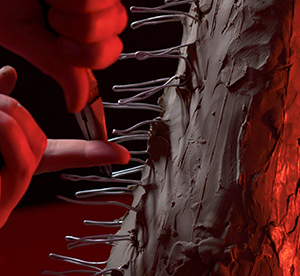 Adding wire for spikes