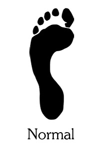 normal footprint shape